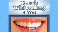 It is natural and the best natural teeth whitener